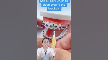 Quy trình chăm sóc răng miệng đúng cách cho người niềng răng | Lạc Việt Intech Niềng Răng #shorts