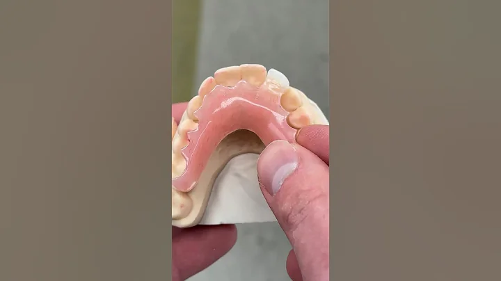 Flipper Partial for a Single Tooth @EnvisiontecMain #envisiontec #dental #teeth#smile#lsk121shorts