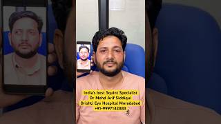 पहले दिन में इतना अच्छा रिजल्ट | life changing transformation after Squint surgery | Dr MA Siddiqui