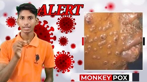 monkey pox alert