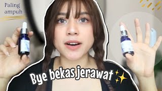 TERBUKTI BEKAS JERAWAT HILANG MUKA CERAH DAN BERSIH | AURA BRIGHT BY ARYANI FITRIANA