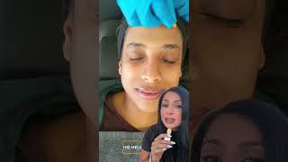 Transform Your Skin With The Perfect Derma Peel