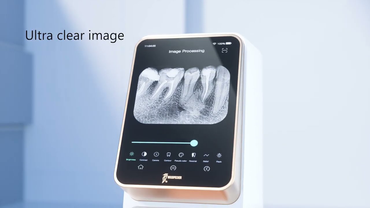 i-Scan - Wireless Imaging Plate Scanner