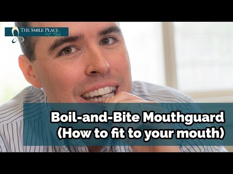 Video: Kaip uždaryti dantų plyšius: 14 žingsnių (su nuotraukomis)