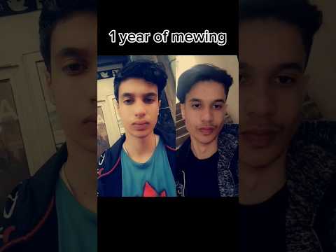 1 year of mewing!