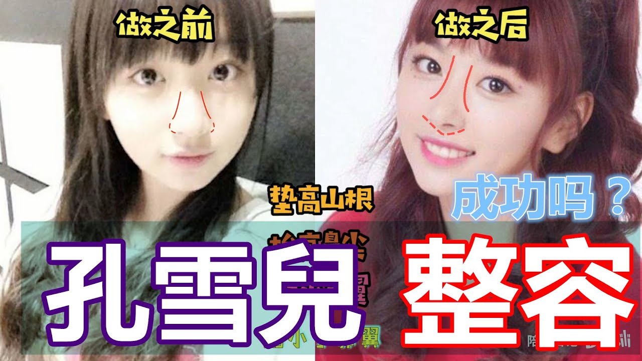 青春有你2 孔雪兒整容成功吗 你介意吗 隆鼻 磨骨 韩国女团脸考古视频青春有你第二季金子涵劉雨昕安崎王承渲申洁虞书欣張楚寒