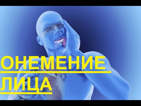 Oнемение лица