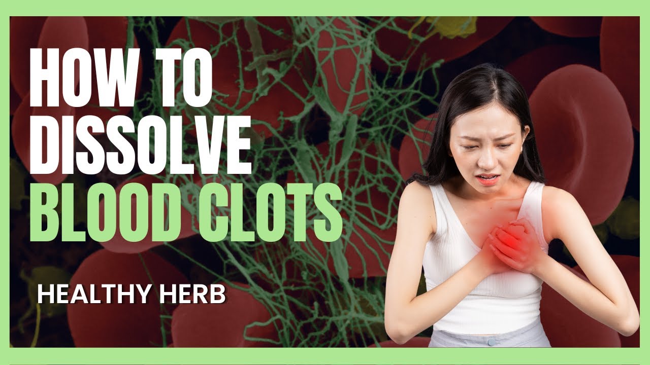 7 Natural Remedies To Dissolve BLOOD CLOTS Boost Vascular Health 7-natural-remedies-to-dissolve-blood-clots-boost-vascular-health