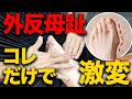 【※超有料級※】たったコレだけで改善する「外反母趾」への秘密のテクニック!