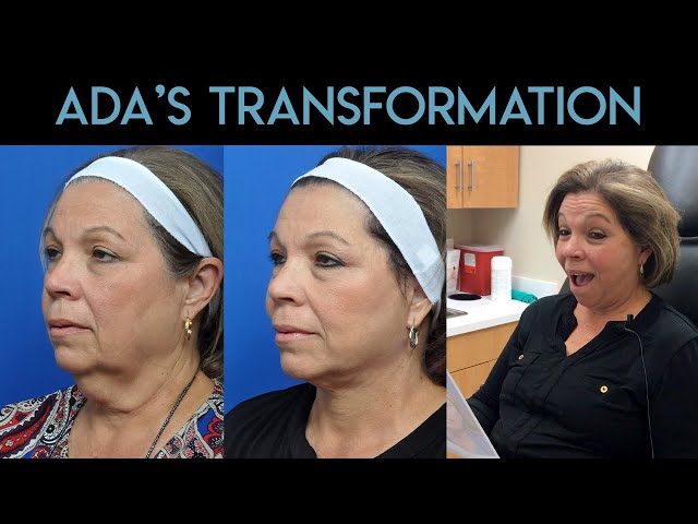Ada's Transformation