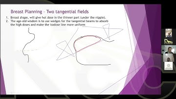 2D to 3D EBRT | Session 7 | Advanced 3D Planning Methods