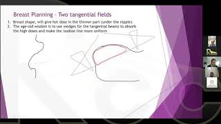 2D to 3D EBRT | Session 7 | Advanced 3D Planning Methods