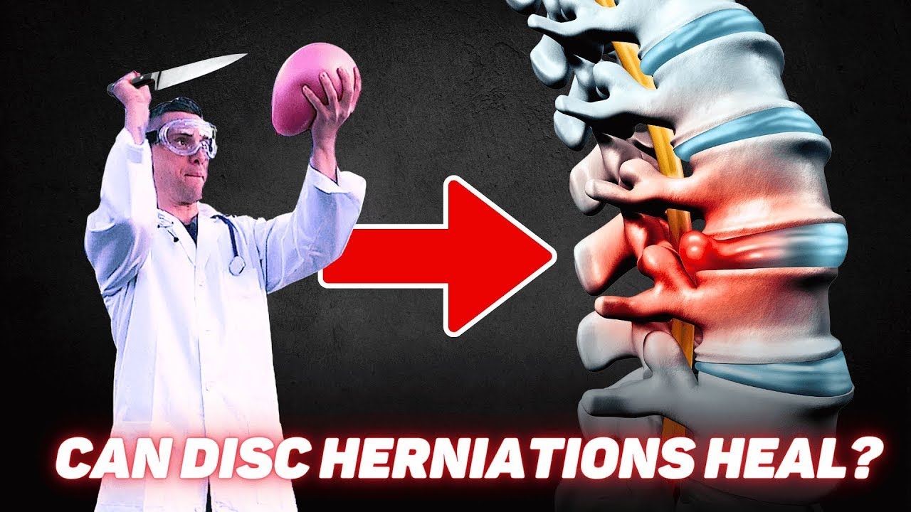 disc-herniation-recovery-time-how-long-to-heal-low-back-pain