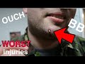 *WORST* AIRSOFT INJURIES