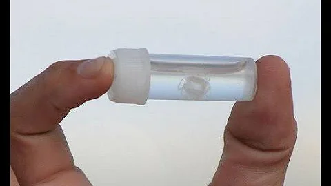 Ируканджи – крошечные, но смертоносные медузы
