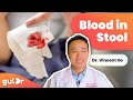 There’s Blood in My Poo, Is It Serious? | GutDr Q&A