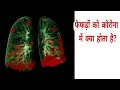 फेफड़ों को क्या होता है CORONA main,How lungs affected in CORONA ?