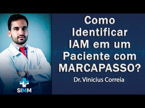 Vídeo: Triagem Negativa Da Doença De Fabry Em Pacientes Com Distúrbios De Condução Que Requerem Marcapasso