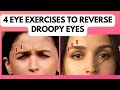 4 Anti Aging Eye Exercises That Can Reverse Alia Bhatt&#39;s DROOPY EYELIDS