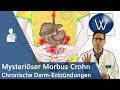 Morbus Crohn: Ursache für unblutigen Durchfall & Bauchschmerz? Chronisch-entzündliche Darmerkrankung