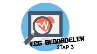 ECG Beoordelen - stap 3 (Hartas)