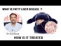 What is Fatty Liver Disease and How is it Treated | Fatty Liver Disease | Fatty Liver | Dr Sandeep
