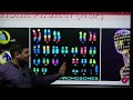MOLECULAR BASIS OF INHERITANCE | HUMAN GENOME PROJECT | CLASS 12TH | BY DR KARAN VARDHANI