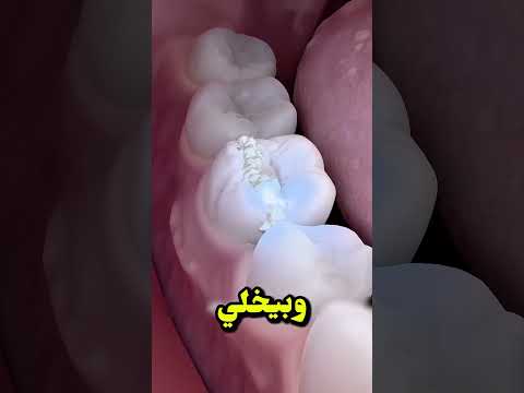 احذر من حبة الفشار اللي ما انفجرتش ممكن تكسر سن ك وانت مش واخد بالك الفشار الأسنان نصائح طبية