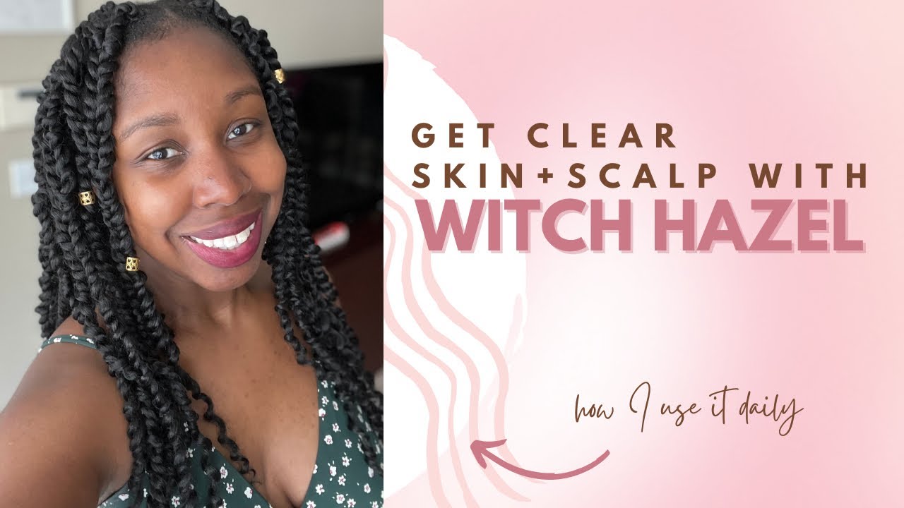 How To Get Clearer Skin Clean Scalp With Witch Hazel YouTube how-to-get-clearer-skin-clean-scalp-with-witch-hazel-youtube