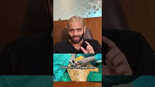 What Every Gynecomastia Patient Should Ask Their Surgeon #gynecomastia #menshealth #tips