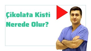 Çikolata Kisti Endometriozis Nerede Olur? Prof Dr Volkan Turan