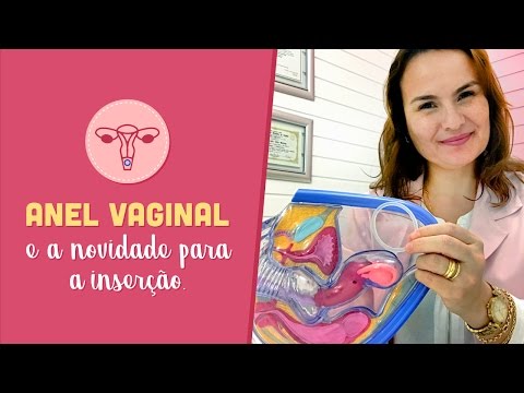 Vídeo: Anel Vaginal Para Controle De Natalidade