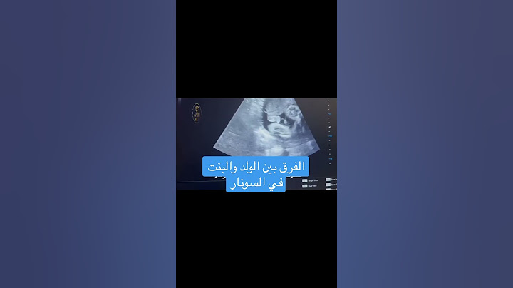 الفرق بين الولد والبنت في السونار  دكتور إيهاب طنطاوي @NESSACLINIC   Boy or Girl by ultrasound