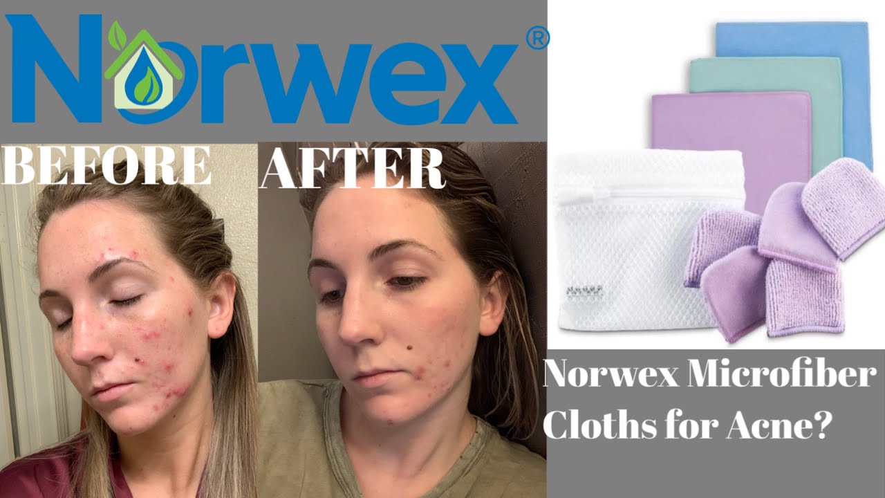 Norwex Face Cloths For Acne Does It Really Work Youtube