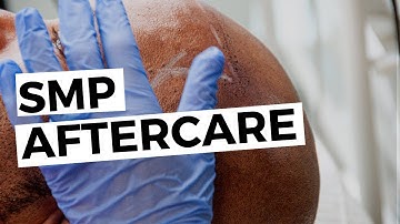What Should I Do After Scalp Micropigmentation? SMP Aftercare Explained