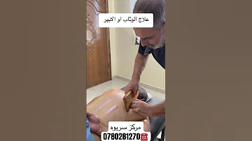 اكسبلور الابهر الاردن السعودية الشقيقة الكتف طبيعي و صحي طقطقه عرق النسا علاج 