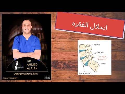 انحلال الفقره الم الظهر - طرق التفكير في العلاج