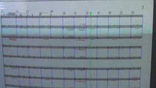 The Forest-Main Theme