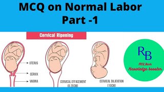 MCQ on Normal Labor Part 1#Causes of Onset of Labor#False Labor Pain# RB MCQ Bank Knowledge. screenshot 5