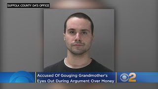 Suffolk DA: Long Island Man Gouges Grandmother's Eyes Out During Dispute Over Money