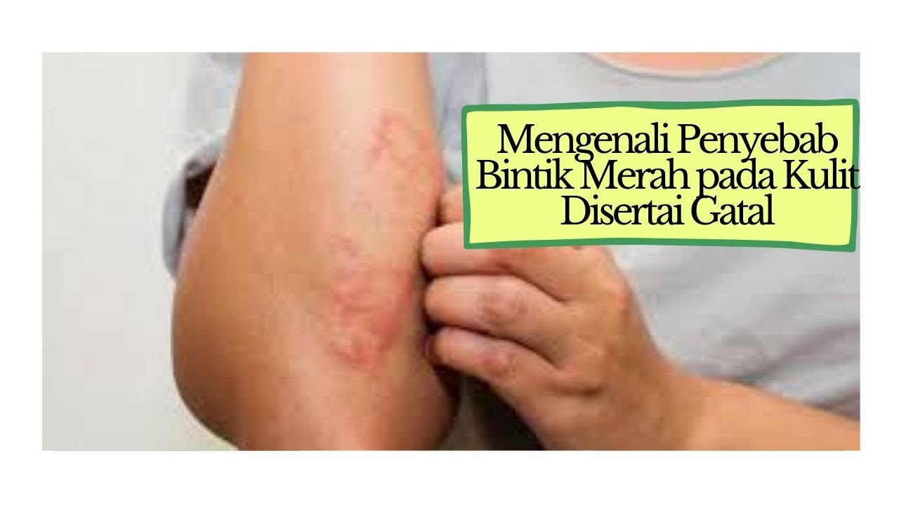 Mengenali Penyebab Bintik Merah pada Kulit Disertai Gatal 