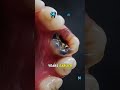 Why are baby teeth important?