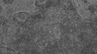 Beating Heart Cells Created from Stem Cells