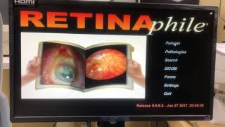 Canon CR-2 with Retinaphile Software