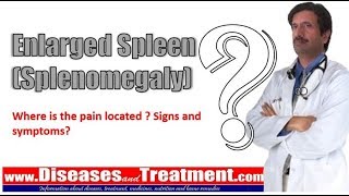 Enlarged Spleen (Splenomegaly): Where is the pain located ? Signs and symptoms?