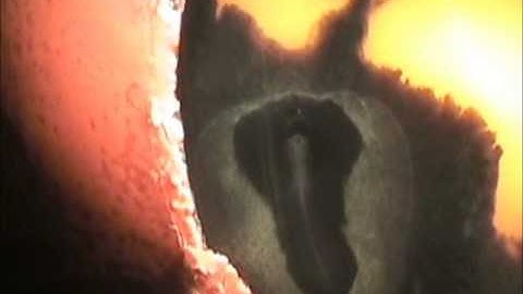 India Ink and Embryo