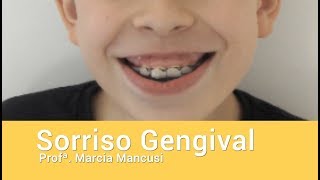 Sorriso Gengival - Profª. Marcia Mancusi - Sobresp