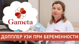 УЗИ Доплер при беременности. Допплерометрия плода. Зачем допплер для беременных