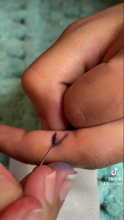Stick & poke