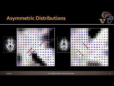 Kurt Schilling: Functional tractography of white matter by HARFI